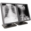 Planar Dome E3 Grayscale 3 MP 20.8 in Dual-Head Flat Panel Medical Display with DX2 PCI Video Board / Dome CXtra Calibration