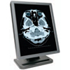 Planar Dome E3n-1 Grayscale 3MP 21.3 in Medical Display