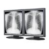 Totoku ME511L Grayscale 5 MP 21.3 in Dual-Head Medical Display with graphics card