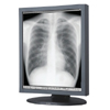 Totoku ME511L Grayscale 5 MP 21.3 in Single-Head Medical Display with graphics card