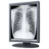 Totoku ME351i 20.8 in 3 MP Single-Head Flat Panel Grayscale Medical Display